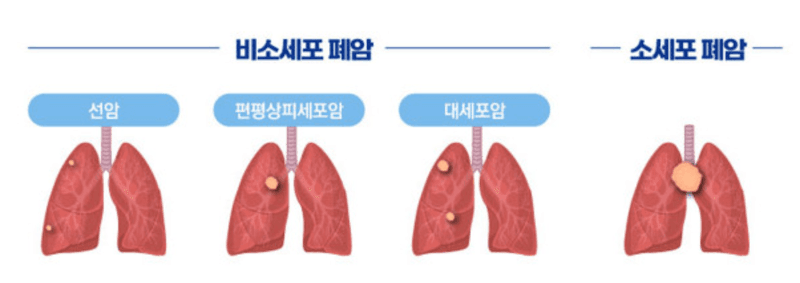 포스트 첨부 이미지